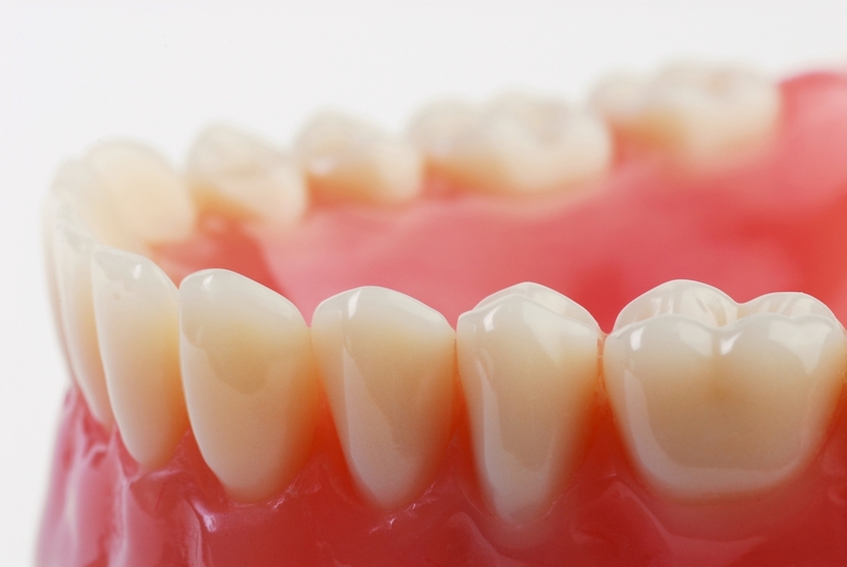 اصلاح عیوب دندان با کمک فناوری نانو در کشور
