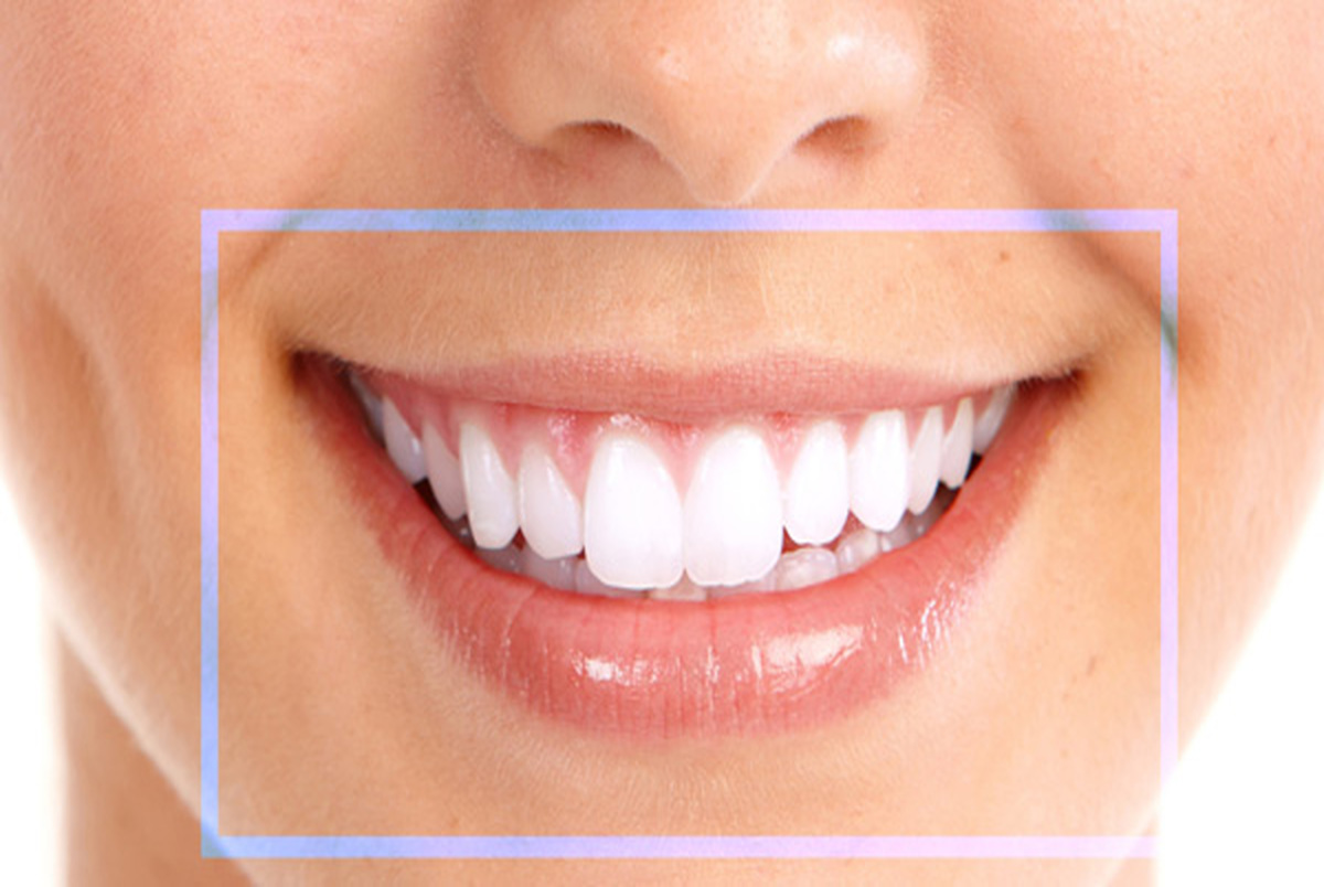 با حفظ دندان، لبخند خود را زیبا کنید