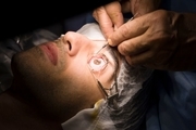 آیا عمل لیزیک چشم بی‌خطر است؟
