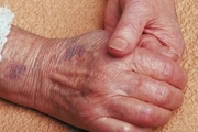 آخرین وضعیت سالمند رها شده در اهواز