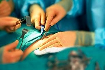 ضرورت قانونگذاری در زمینه اعمال جراحی زیبایی  بی‌تفاوتی و سکوت مسئولان در خصوص افزایش عوارض جراحی‌های زیبایی