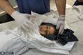 شهادت کودکان فلسطینی در حمله رژیم اسرائیل + عکس های دردناک