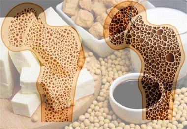 درمان پوکی استخوان با نانو حباب‌ها
