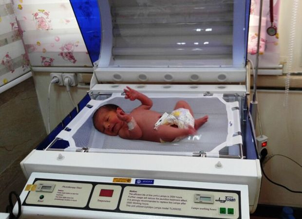 بخش مراقبت ویژه نوزادان در بیمارستان دهلران راه اندازی می شود