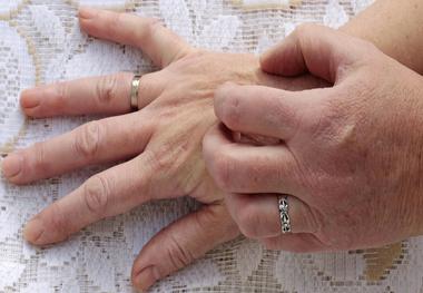 آبی شدن رنگ پوست چه دلایلی دارد؟
