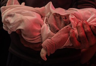 راز دردناک در مورد شهادت کودکان غزه/ چرا هیچ علایمی بر روی پیکر برخی از کودکان غزه وجود ندارد؟