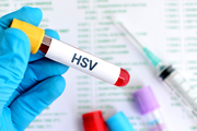مقابله با ویروس HSV با استفاده از فناوری‌نانو