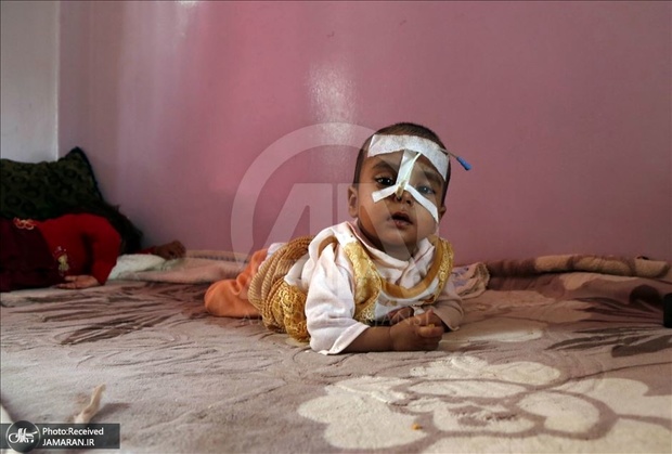 تصاویر تکان دهنده از بحران انسانی یمن