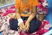 دختر 4ساله با کابل برق توسط عمویش شکنجه شد