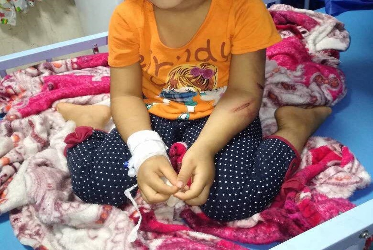 دختر 4ساله با کابل برق توسط عمویش شکنجه شد