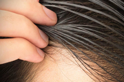 ۱۰ درمان خانگی برای از بین بردن موهای چرب
