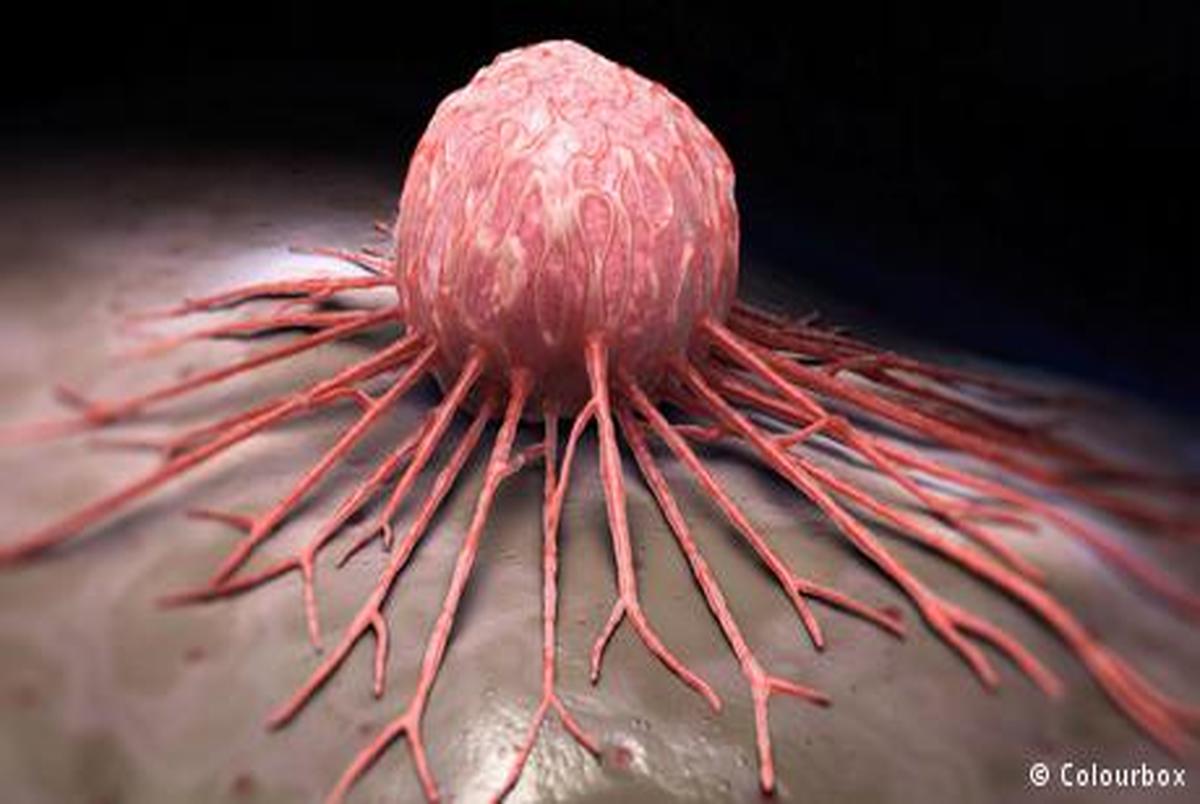 کلسترول بالا رشد تومورهای سرطانی را افزایش می‌دهد