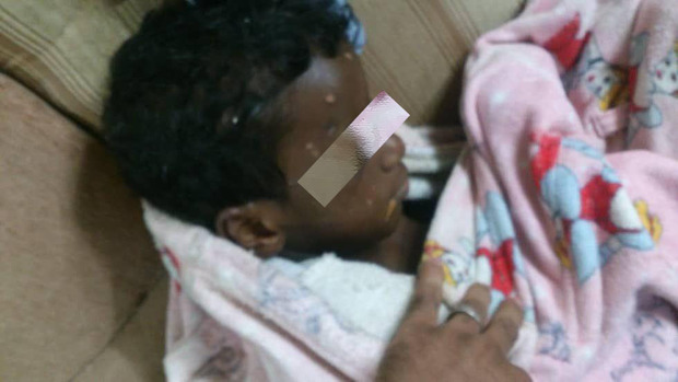 هشدار/ حاوی تصاویر دلخراش؛ کودک آزاری وحشتناک در بوشهر
