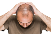 چه میزان ریزش مو طبیعی است؟+ راه های درمان