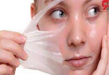  پوست آسیب دیده را در ۱۰ ثانیه ترمیم کنید!