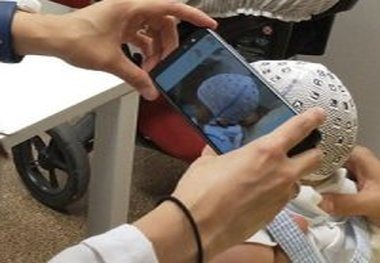 ارزیابی جمجمه نوزادان با موبایل
