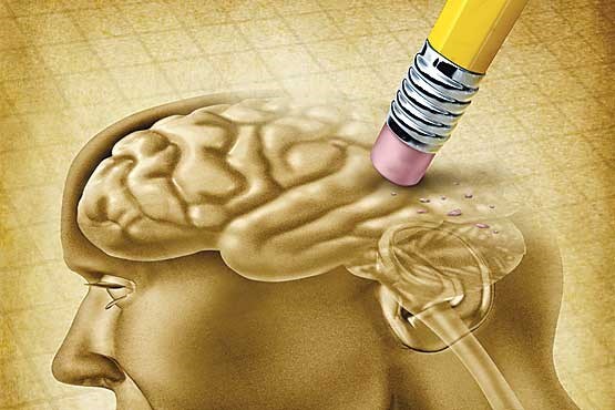 افزایش ریسک بروز زوال عقل در بیماران مبتلا به سرطان پروستات