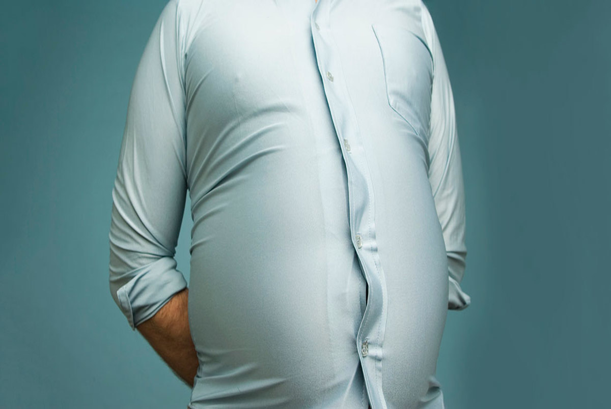مردان چاق در معرض ابتلا به پروستات