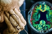هر تجربه بد، چهارسال عقل را پیر می کند! / موقعیت ها و ویتامین هایی که به آلزایمر می انجامد؟