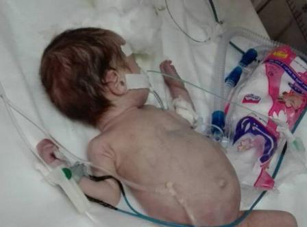 خبر فوت نوزاد به دلیل نبود پزشک در بیمارستان داراب تکذیب شد