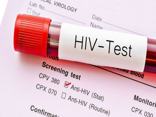 تمام اقدامات تشخیصی برای شناسایی مبتلایان به HIV مطابق پروتکل است