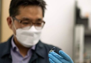 این ایمپلنت از اضافه وزن جلوگیری می کند!