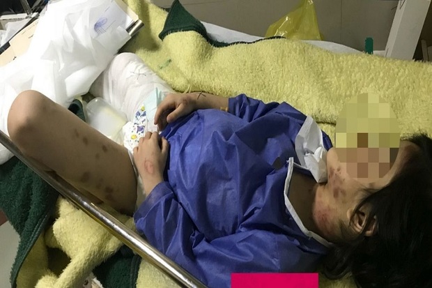 کودکی در مهاباد مورد ضرب و شتم شدید قرار گرفت
