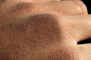 اعصاب پوست عامل محافظ در برابر عفونت های پوستی