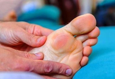 
چگونه تاول پا را مداوا کنیم؟