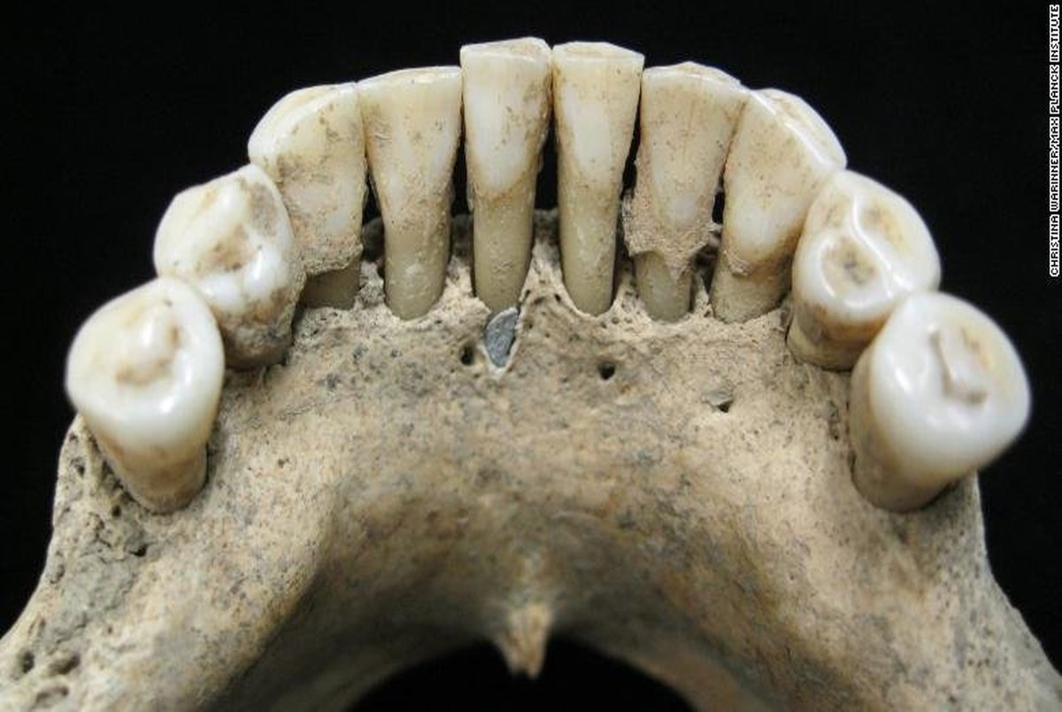 سنگ لاجورد قیمتی در دهان زن هزارساله آلمانی کشف شد+ عکس