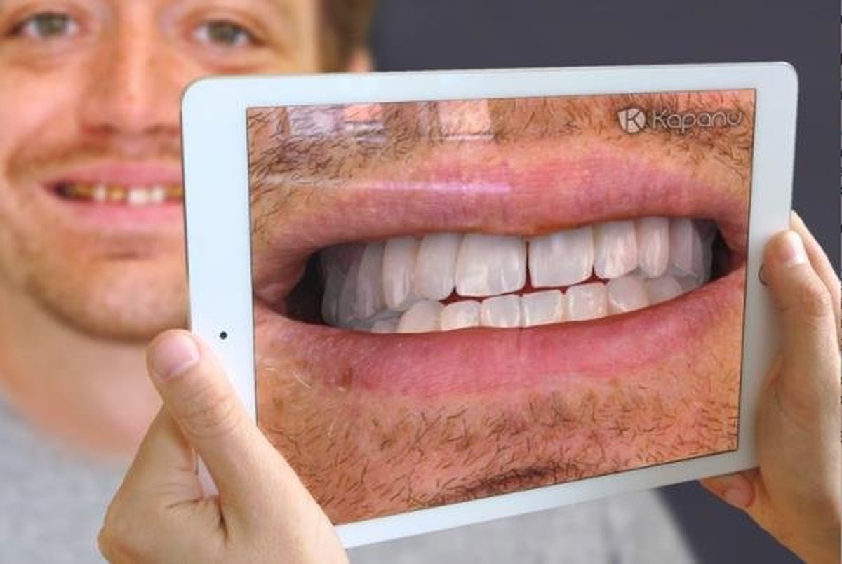 آینه ای که لبخندتان را پیش از جراحی دندان نشان می دهد
