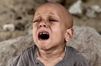  فریاد گرسنگی در چشمان یک کودک (1)
