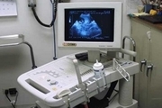 یک دستگاه سونوگرافی به بیمارستان دیر اهدا شد