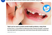 اختلالات روانی از روی مینای ضعیف دندان شیری قابل تشخیص شد
