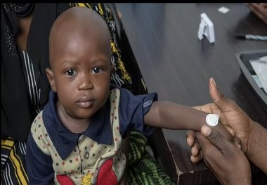 واکسن سرخک و سرخجه بدون درد از راه رسید
