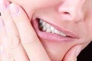 
چه می شود که دندان ها کج می شوند؟