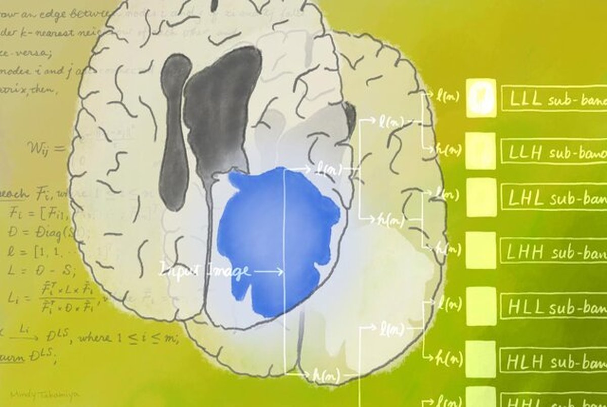 درمانی برای تومور مغزی با به کارگیری هوش مصنوعی