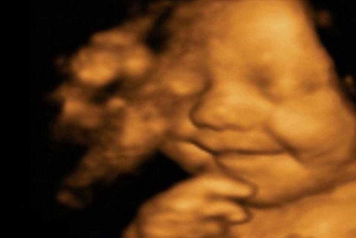 خوشحال ترین بچه دنیا متولد شد! +عکس