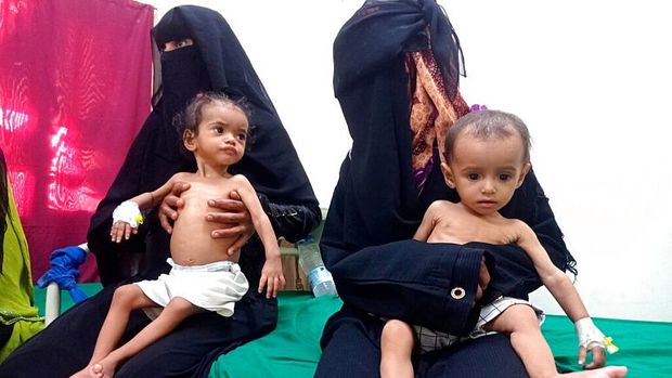 یونیسف: در یمن هر 10 دقیقه یک کودک می‌میرد