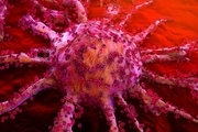 درمان ۳ نوع سرطان با کمک سلول های بنیادی 