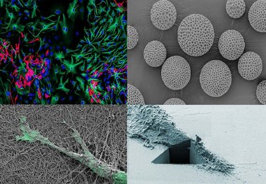 سلول‌های سرطانی، برنده جایزه عکاسی شدند!
