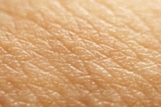 چند درمان خانگی برای برطرف کردن قارچ پوستی