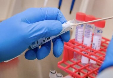 
تست پادتن ویروس کرونا ماه دیگر آزمایش می شود