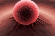 کشف علت سرطان خون در دوران کودکی