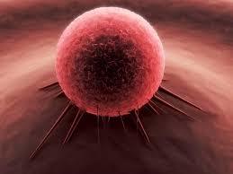 سرطانی که در ایران درمان شدنی است