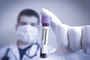 وزارت بهداشت: آزمایش کرونا برای کسانی که علائم دارند رایگان است