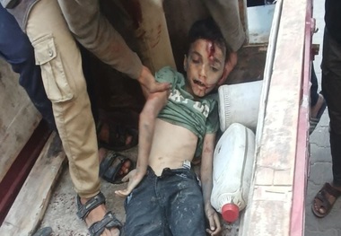 شهادت دردناک کودکان فلسطینی در حمله اسرائیل + تصاویر به شدت وحشتناک