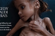 گزارشی دردناک از کودکانی که مشتی پوست و استخوانند