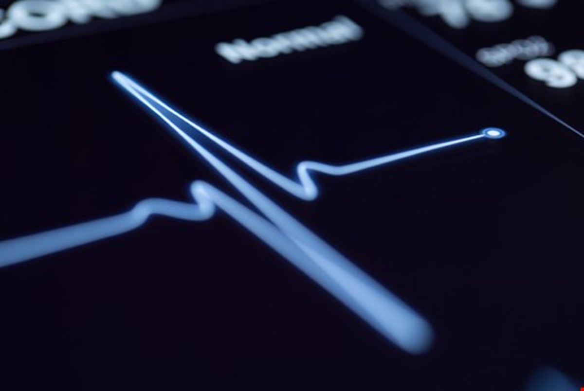 هوش مصنوعی در پیش بینی حملات قلبی روی دست پزشک ها میزند!