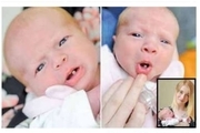 دختری که با یک دندان به دنیا آمد+عکس
